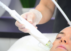 FOCAS DUAL lifting facial non-chirurgical pentru piele lăsată și anti-îmbătrânire